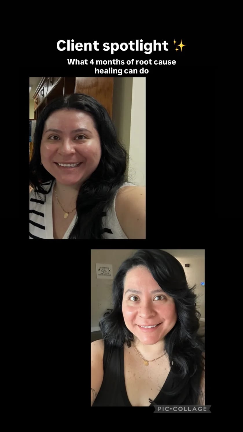 Marsha G. before and after - 4 months of root cause healing